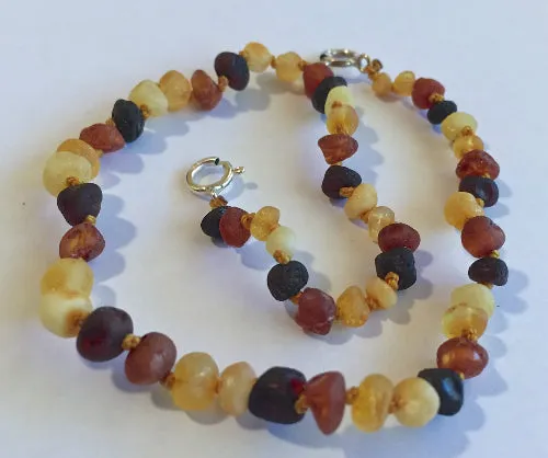Baltic Amber Adjustable Anklet - Diversity