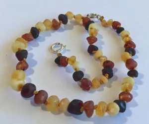 Baltic Amber Adjustable Anklet - Diversity